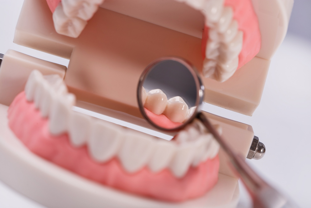 Próteses Dentárias Modernas: Evolução, Conforto e Funcionalidade na Reabilitação Oral 3 protese dentaria